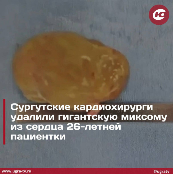 Удалили гигантскую миксому Удалили гигантскую миксому